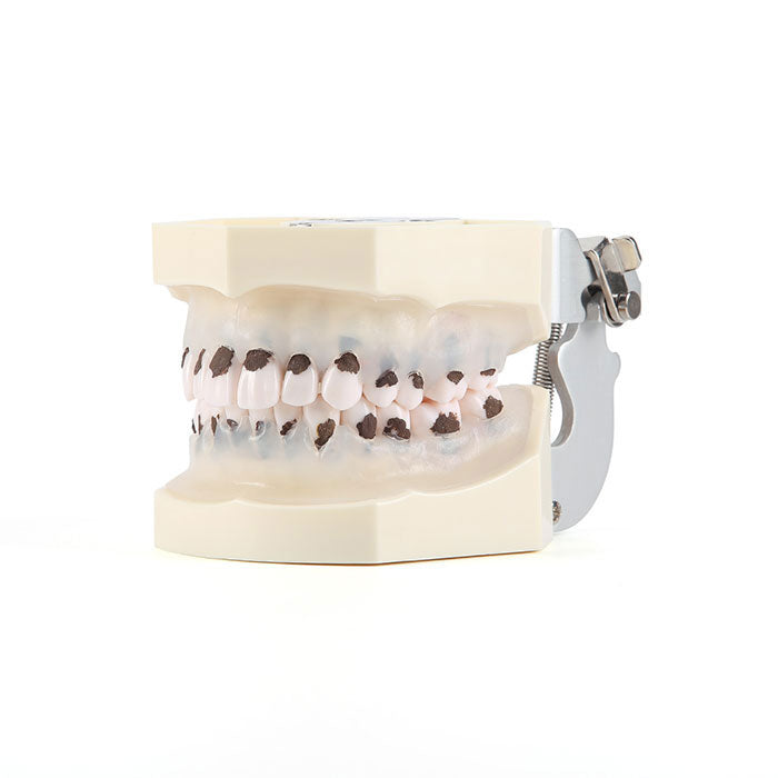 Preparation dental cast mold resin dentistry teaching model practice teeth  model