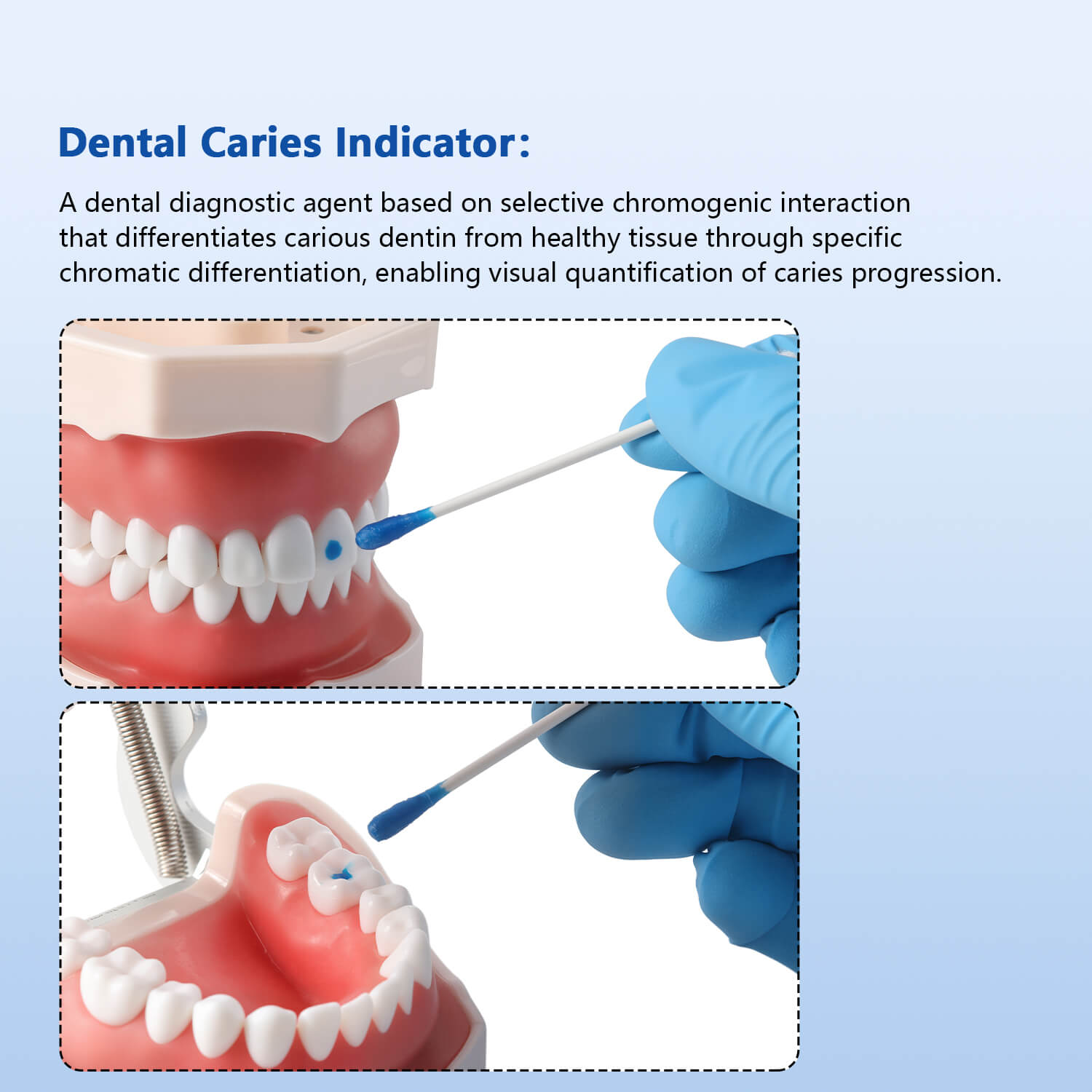 Dental Caries Indicator Diagnostic Agent Caries Finder Locating Root Canal Orifices 5ml - azdentall.com