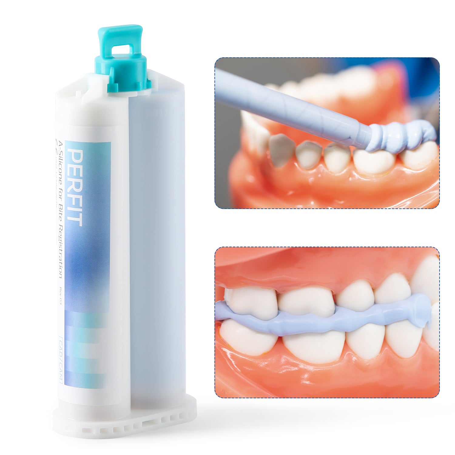 Dental Bite Registration Material Fast Set 2 Cartridges Of 50ML Mixing Tips