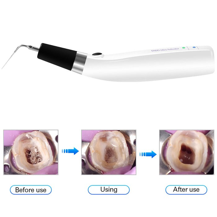 Dental Ultrasonic Activator Irrigator with 6 Tips Cordless Ultrasonic Operation 300° Rotation-azdentall.com