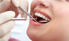 Tips For Filling Teeth