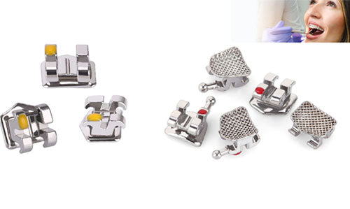 Bracket – An Essential Material For Orthodontics