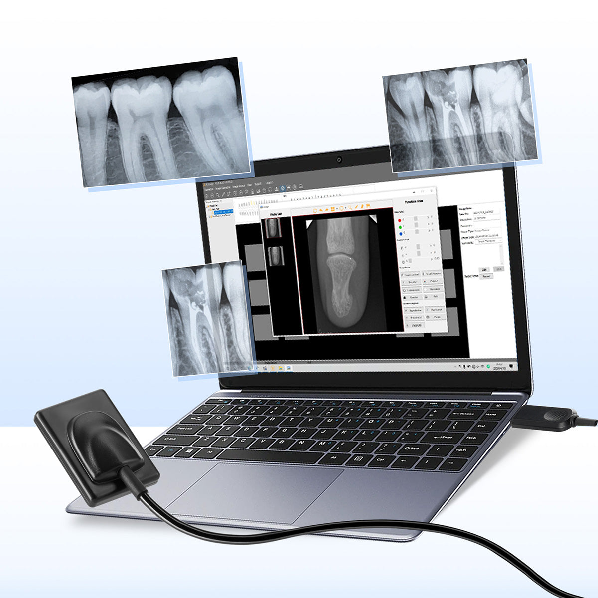 Dental Sensor X-Ray Digital Sensor Intraoral Digital System HD Image Size1/Size2 - azdentall.com