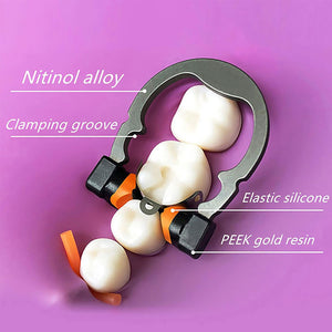 Dental Sectional Matrix System Nickel Titanium Matrices Clamp Clip Ring Small/Medium/Big Wide - azdentall.com