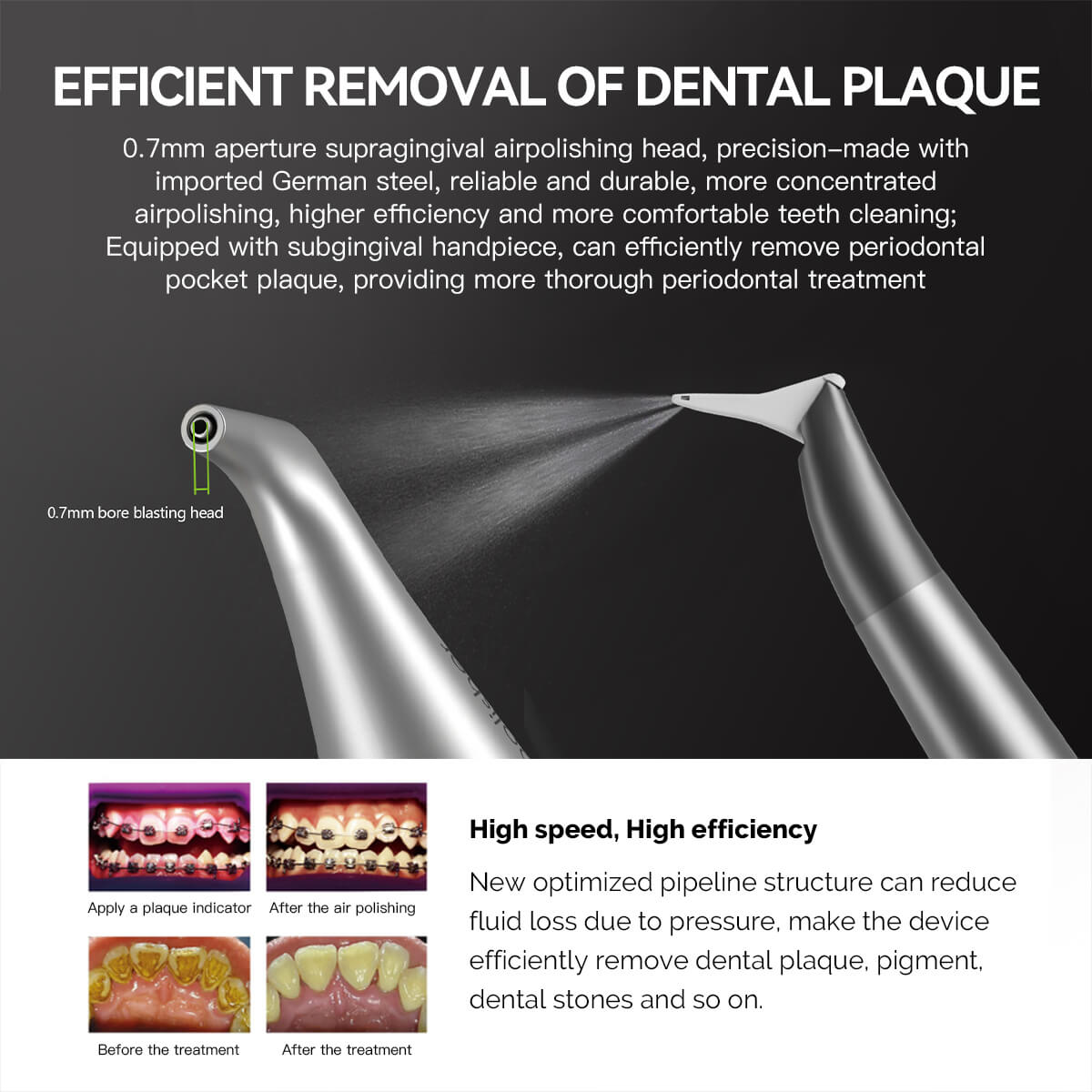 Dental Air Polisher Nozzles Gingival & Subgingival Sandblasting Handle for EMS AIR-FLOW - azdentall.com