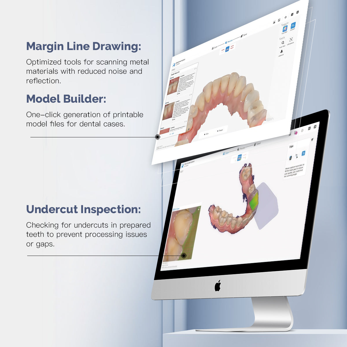 Dental Intraoral 3D Scanner with Software USB Real Color CAD/CAM Chair Side System - azdentall.com