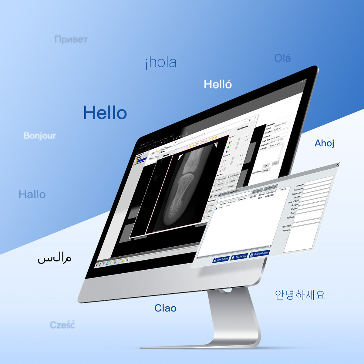 Dental Sensor X-Ray Digital Sensor Intraoral Digital System HD Image Size1/Size2 - azdentall.com