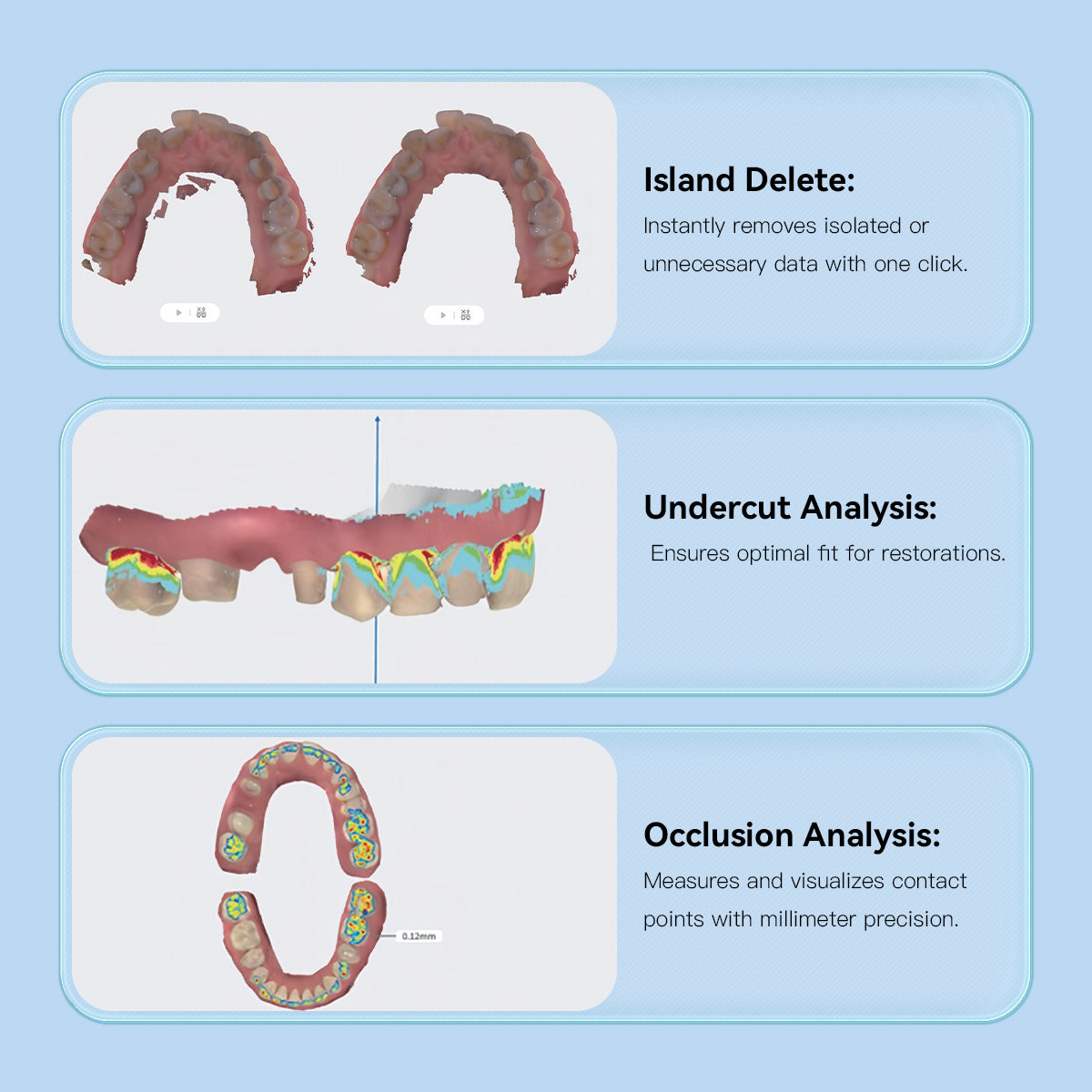 Dental 3D Intraoral Scanner with Software AI Tech Real Color CAD/CAM Digital Impression USB - azdentall.com