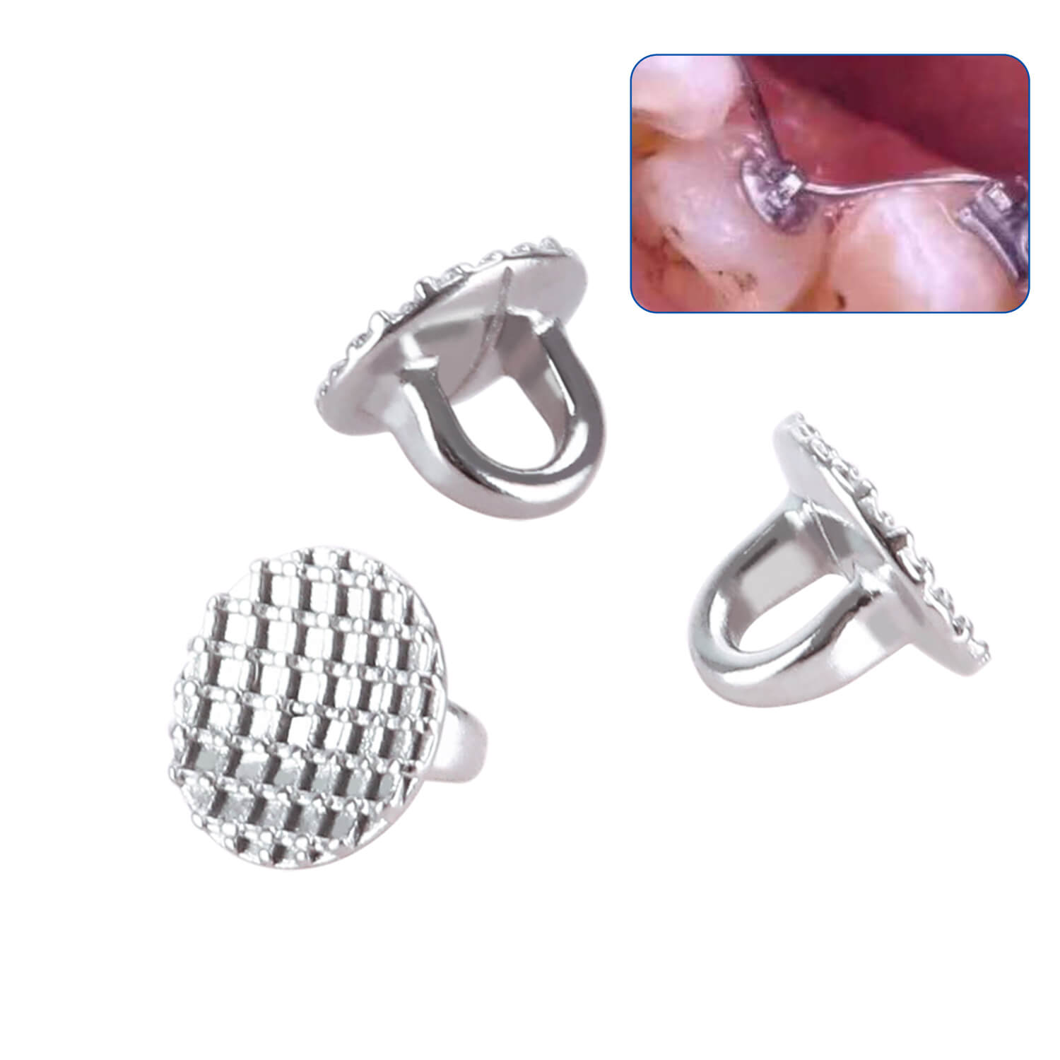AZDENT Orthodontic Lingual Button Bondable Monoblock Direct Bond Eyelet Round Base 50pcs/Box - azdentall.com