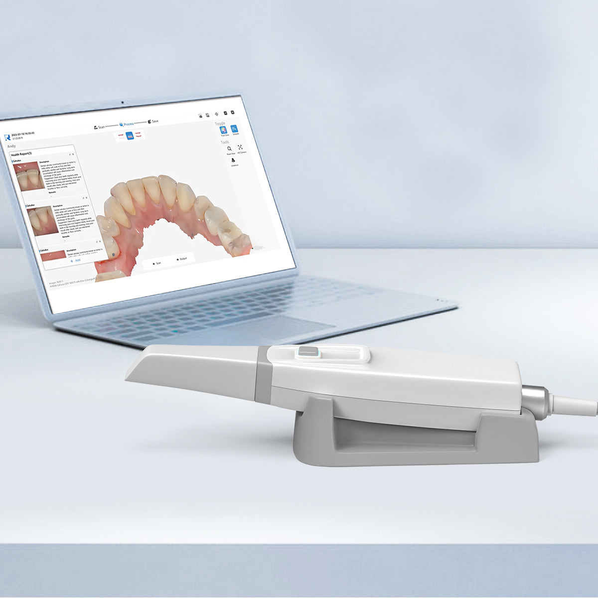 Dental Intraoral 3D Scanner with Software USB Real Color CAD/CAM Chair Side System - azdentall.com