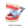 Dental Mouth Opener Lip Cheek Retractor Clear Plastic Posterior Tooth Support - azdentall.com