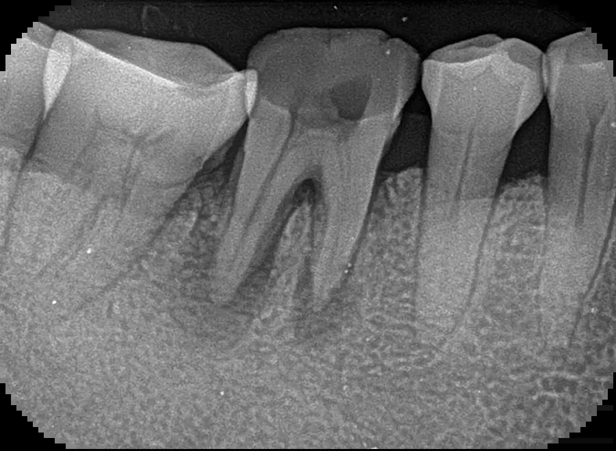 Woodpecker Dental Digital X-ray Imaging Plate Scanner i-Scan Wireless W/Screen - azdentall.com