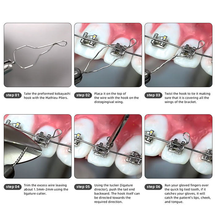 Dental Orthodontic Wire Kobayashi Ligature Ties Long / Short Twist / 0.010 / 0.012 / 0.014 100pcs/Pack - azdentall.com
