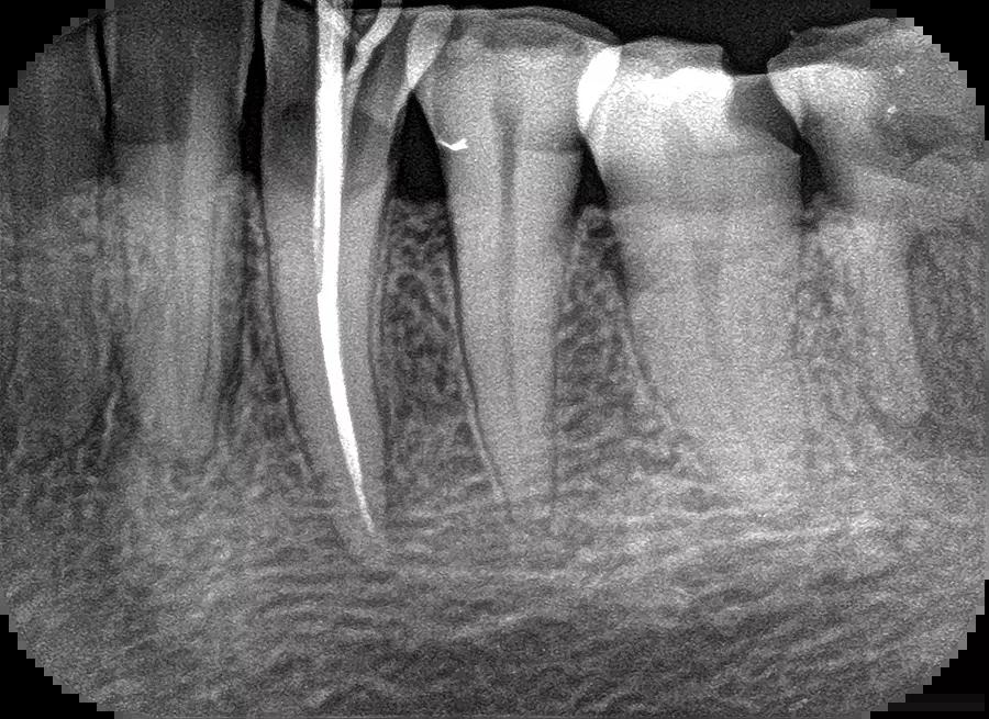 Woodpecker Dental Digital X-ray Imaging Plate Scanner i-Scan Wireless W/Screen - azdentall.com