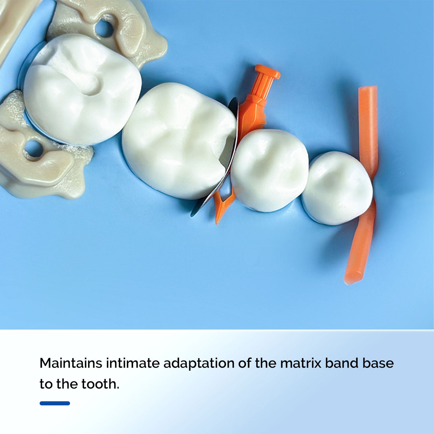 Dental Disposable Wedges With Hole Tooth Gap Wedge Plastic 5 Sizes 120pcs/Box - azdentall.com
