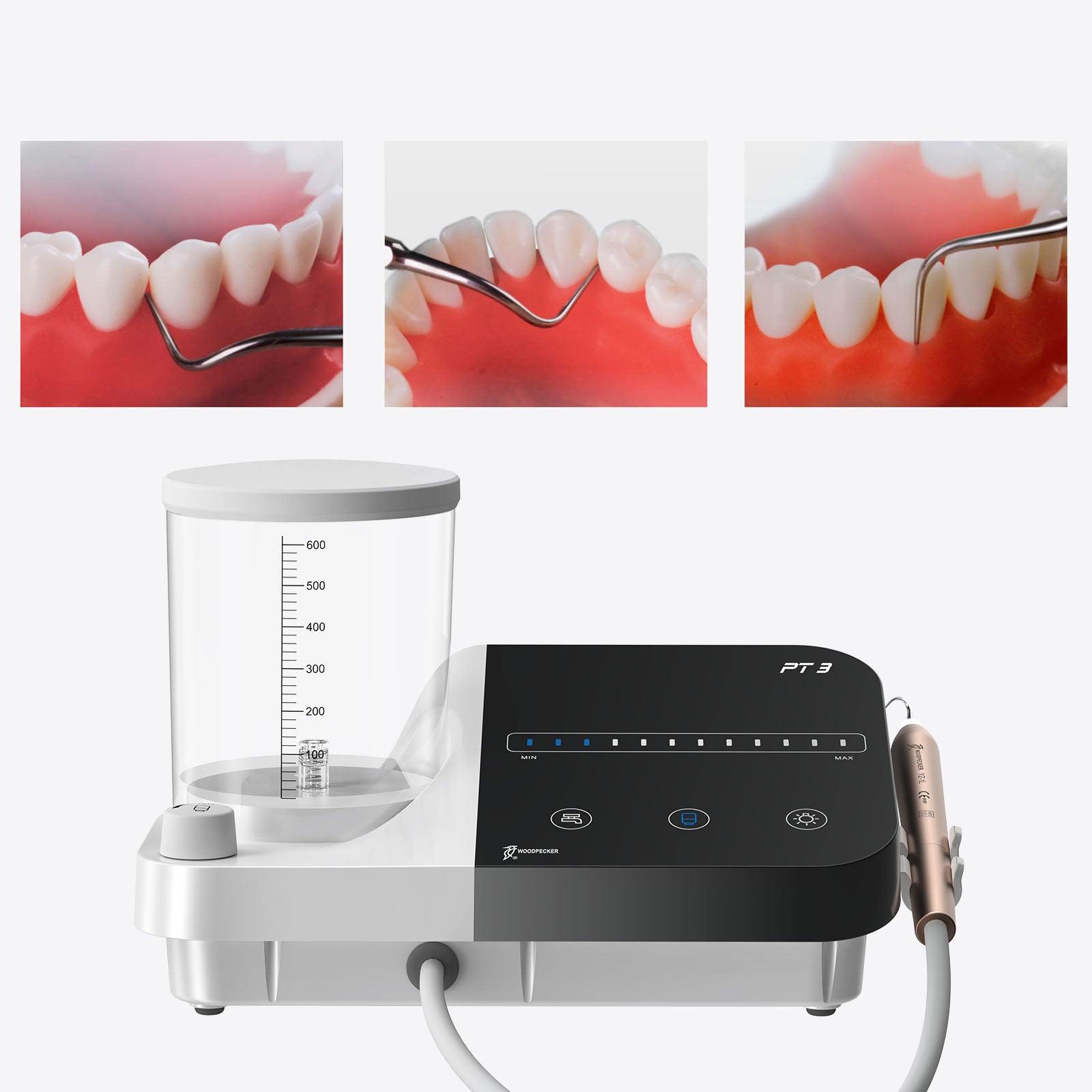 WOODPECKE PT3 Dental Periodontal Treatment Device Auto Water Supply System - azdentall.com