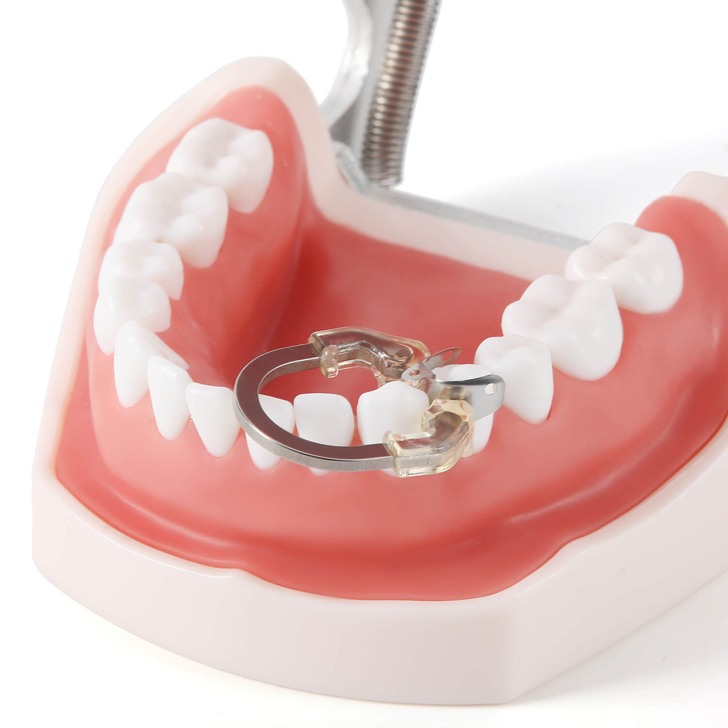 Dental Sectional Matrix System Sectional Contoured Matrix Bands Nickel Titanium Deep Clamping Ring Orange/Transparent 1 PC - azdentall.com