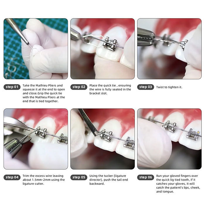 Dental Orthodontic Wire Preformed Ligature Ties Stainless Steel Long / Short Twist / 0.010 / 0.012 / 0.014 100pcs/Pack - azdentall.com