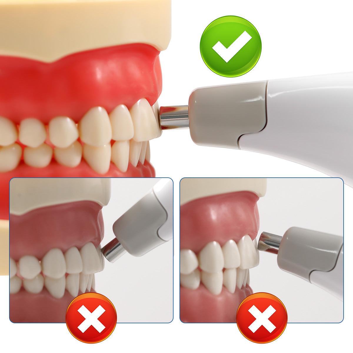Dental Digital Shade Guide Tooth Color Comparator