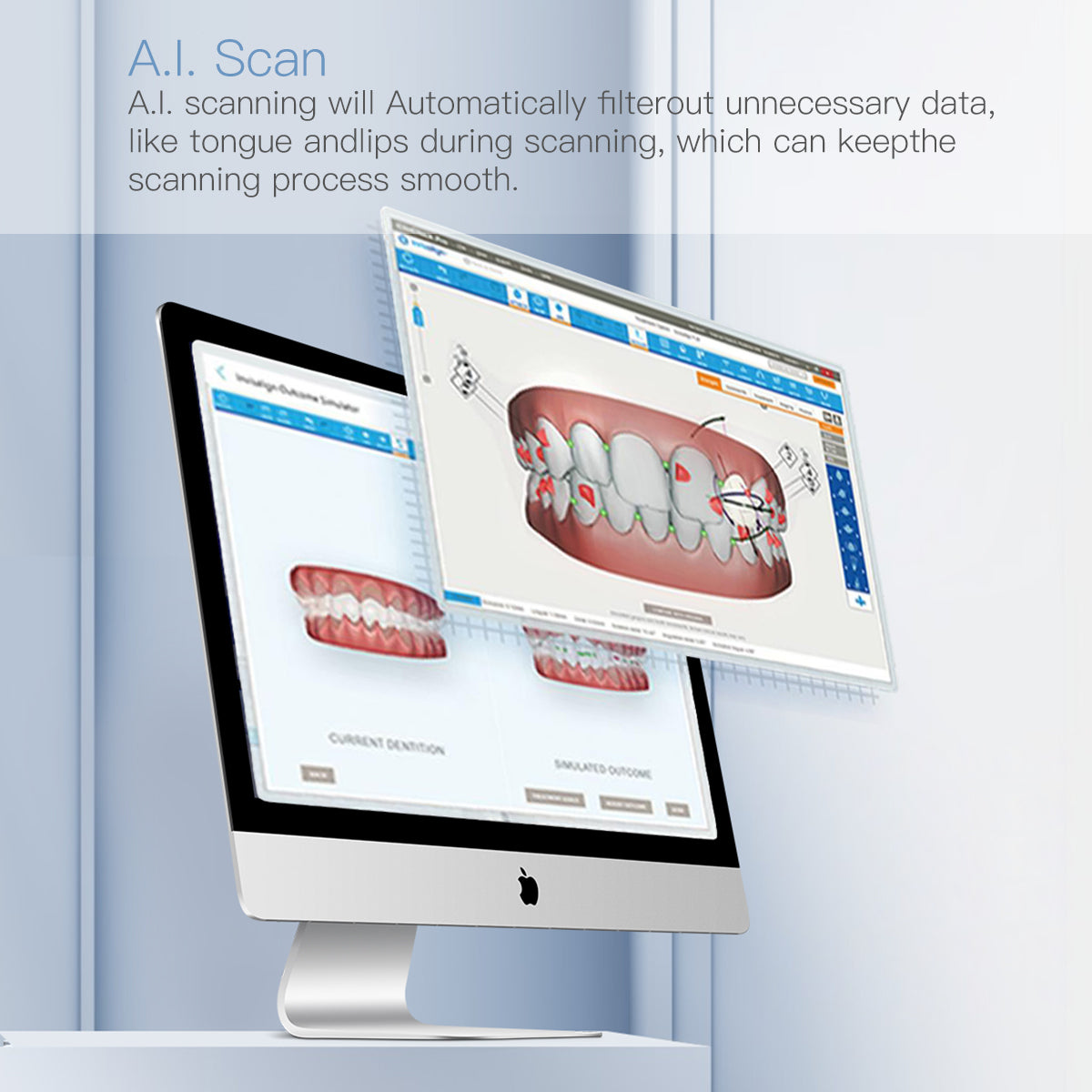 Dental 3D Intraoral Scanner with Software AI Tech Real Color CAD/CAM Chair Side System USB - azdentall.com