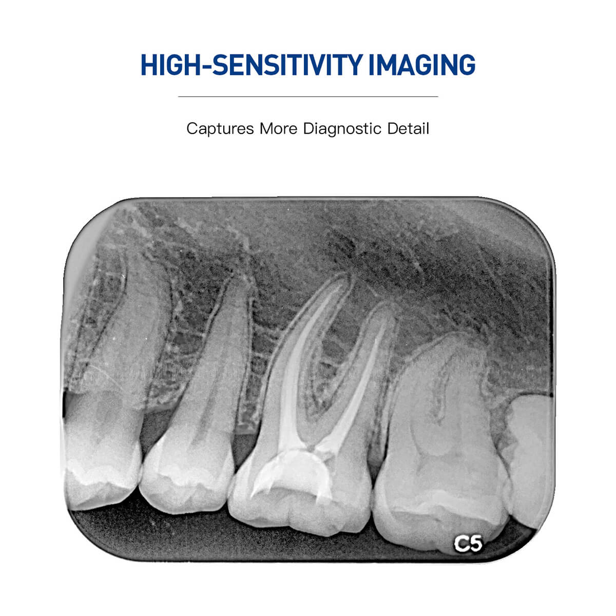 Dental Digital X-ray Imaging Phosphor Plate size 0# 1# 2# 3# - azdentall.com