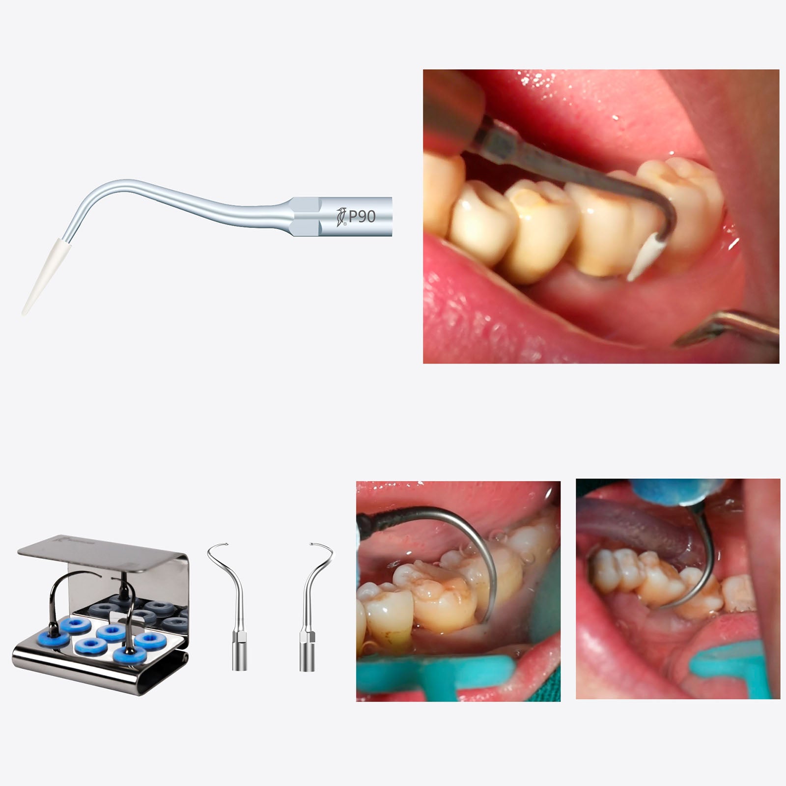 WOODPECKE PT3 Dental Periodontal Treatment Device Auto Water Supply System - azdentall.com
