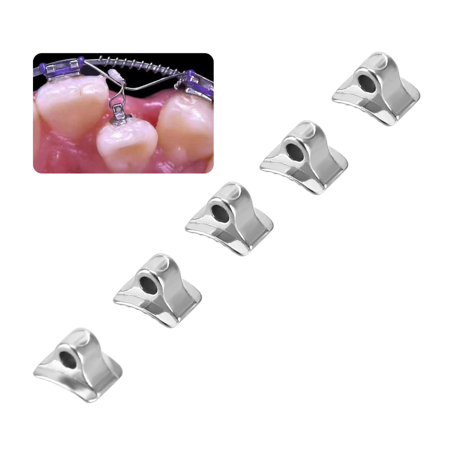 AZDENT Orthodontic Lingual Button Bondable Monoblock Direct Bond Eyelet Rectangular Base 50pcs/Box - azdentall.com