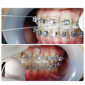 Dental Orthodontic Wire Preformed Ligature Ties Stainless Steel Long / Short Twist / 0.010 / 0.012 / 0.014 100pcs/Pack - azdentall.com