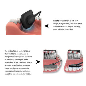 Dental X-Ray Digital RVG Sensor XVS2121 Size 1.0 with Software - azdentall.com