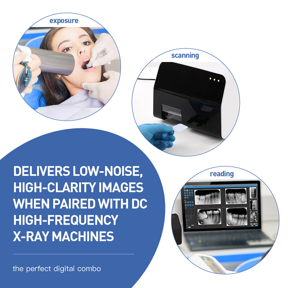 Dental Digital X-ray Imaging Phosphor Plate size 0# 1# 2# 3# - azdentall.com
