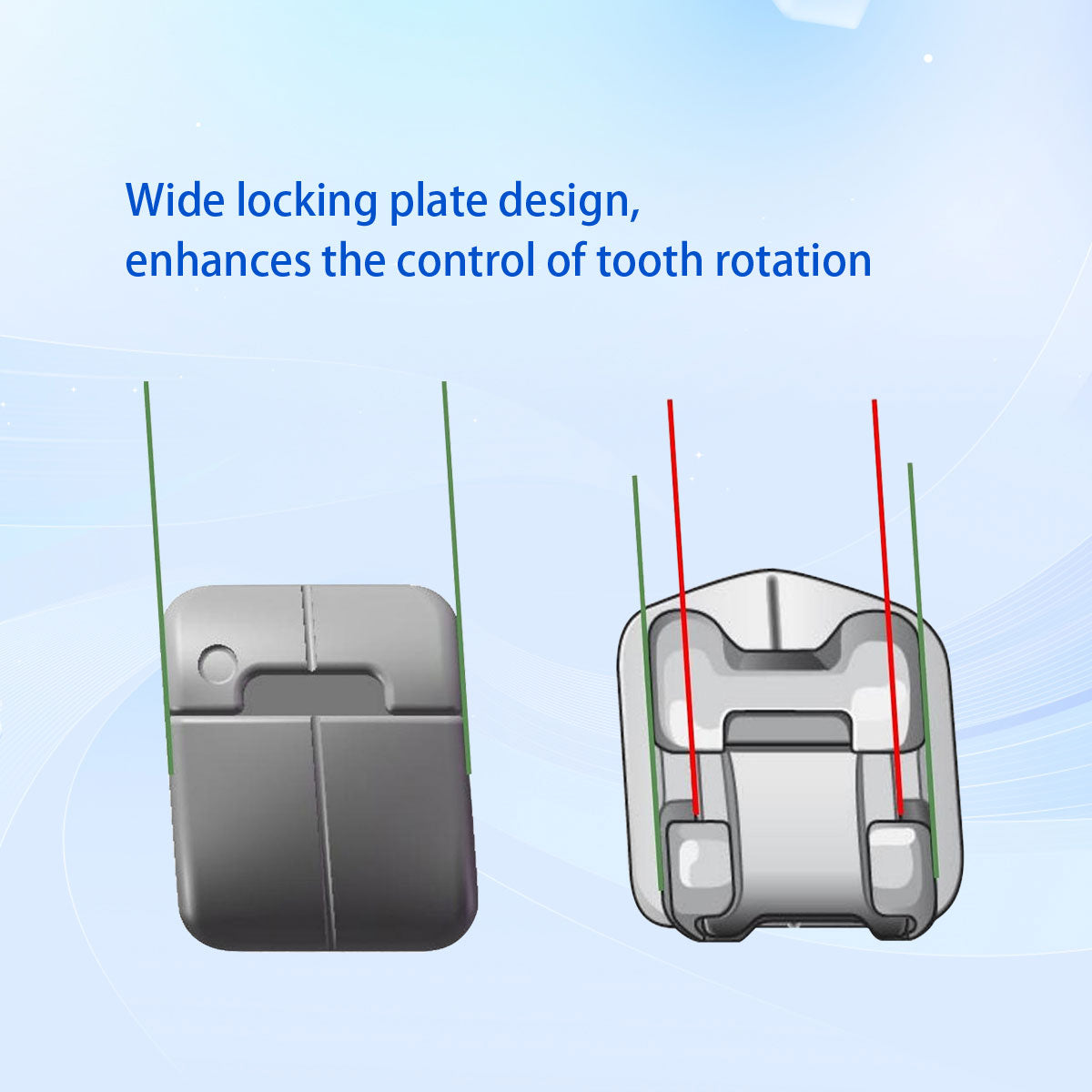 AZDENT Dental Metal Self-Ligating Brackets Multiple Hooks Roth/MBT .022 28pcs/Box - azdentall.com