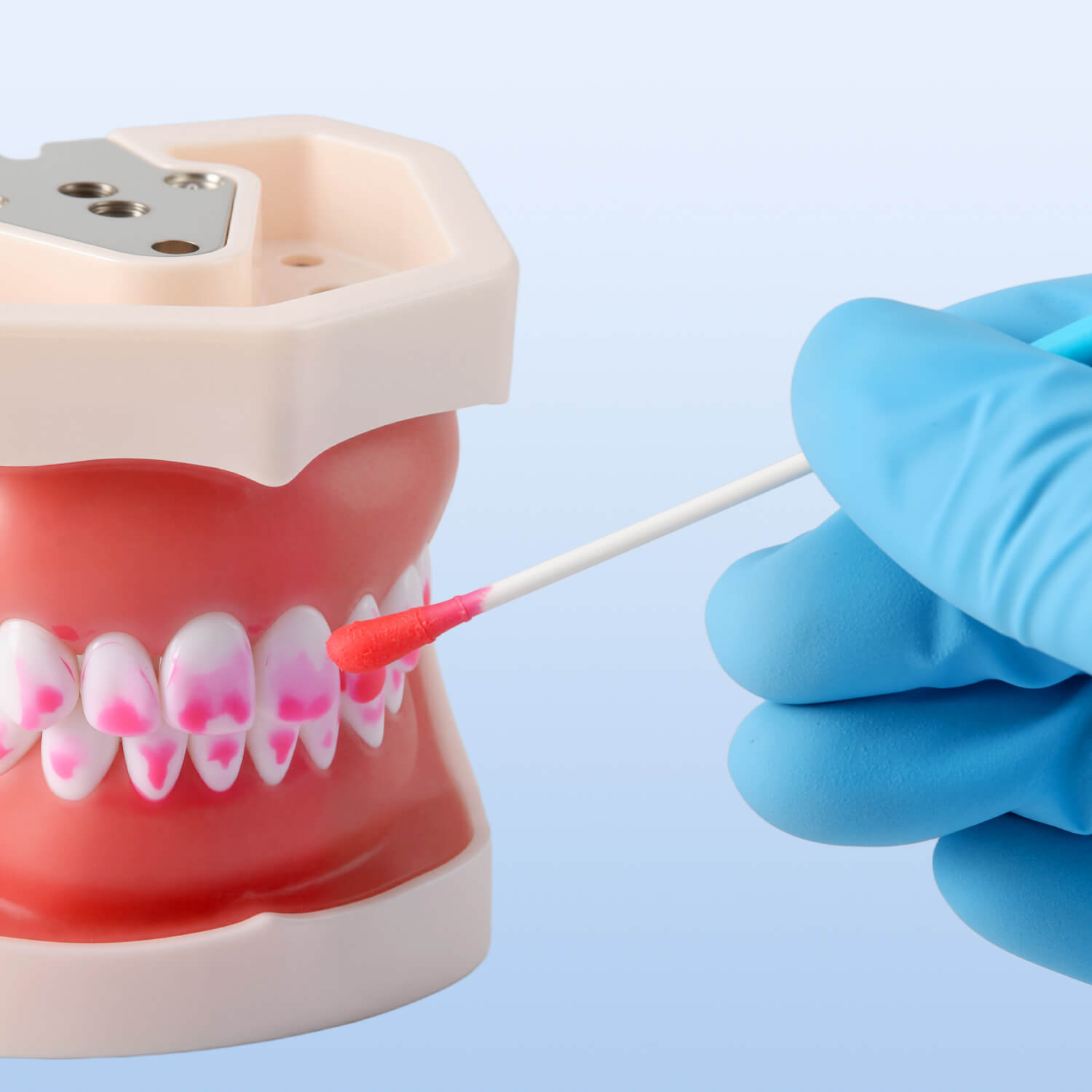 Dental Plaque Disclosing Agent Oral Tartar Test Examination Plaque Indicator 5ml - azdentall.com