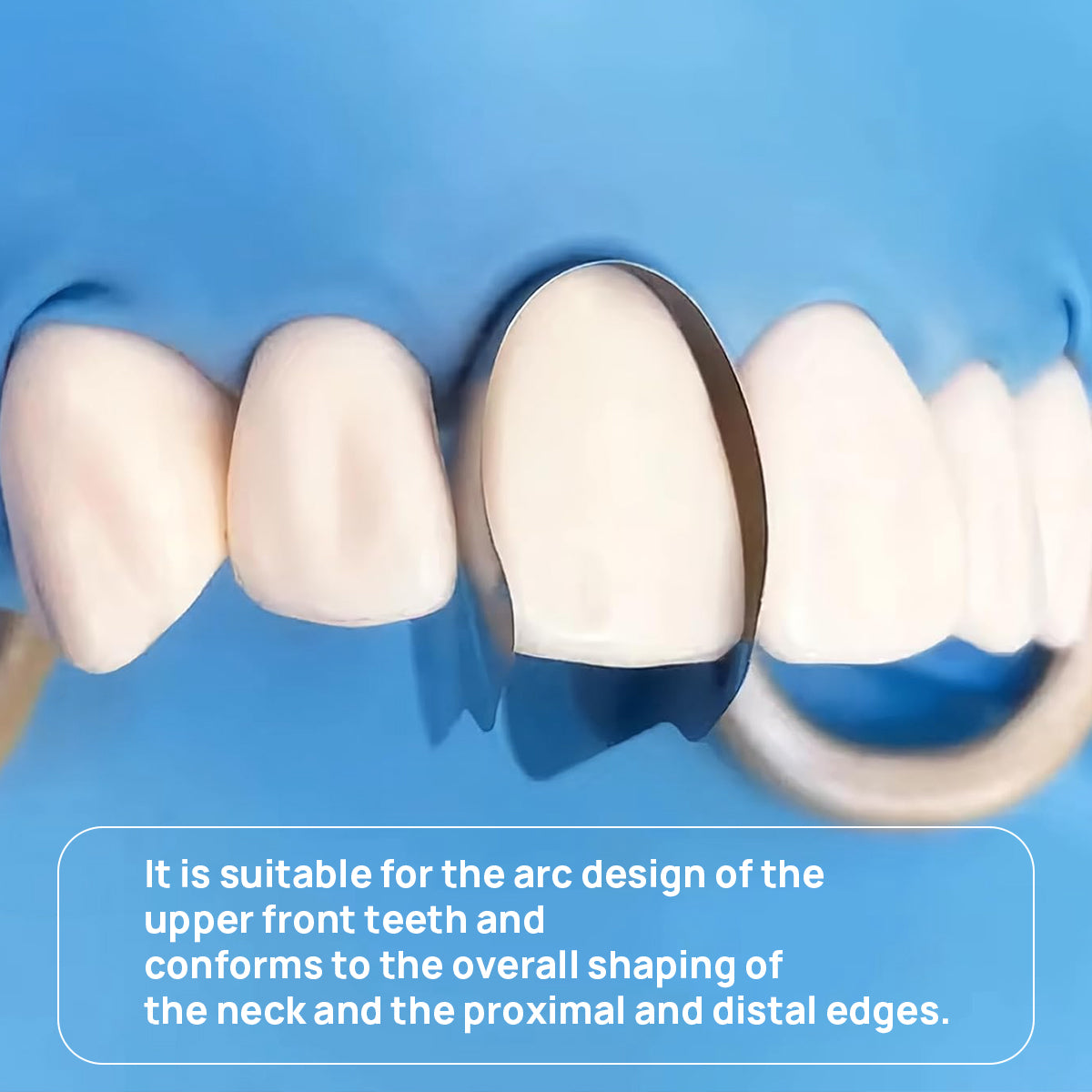 Dental Matrix Contoured Anterior Metal Matrix Bands Sectional 0.03mm 30pcs/Box - azdentall.com