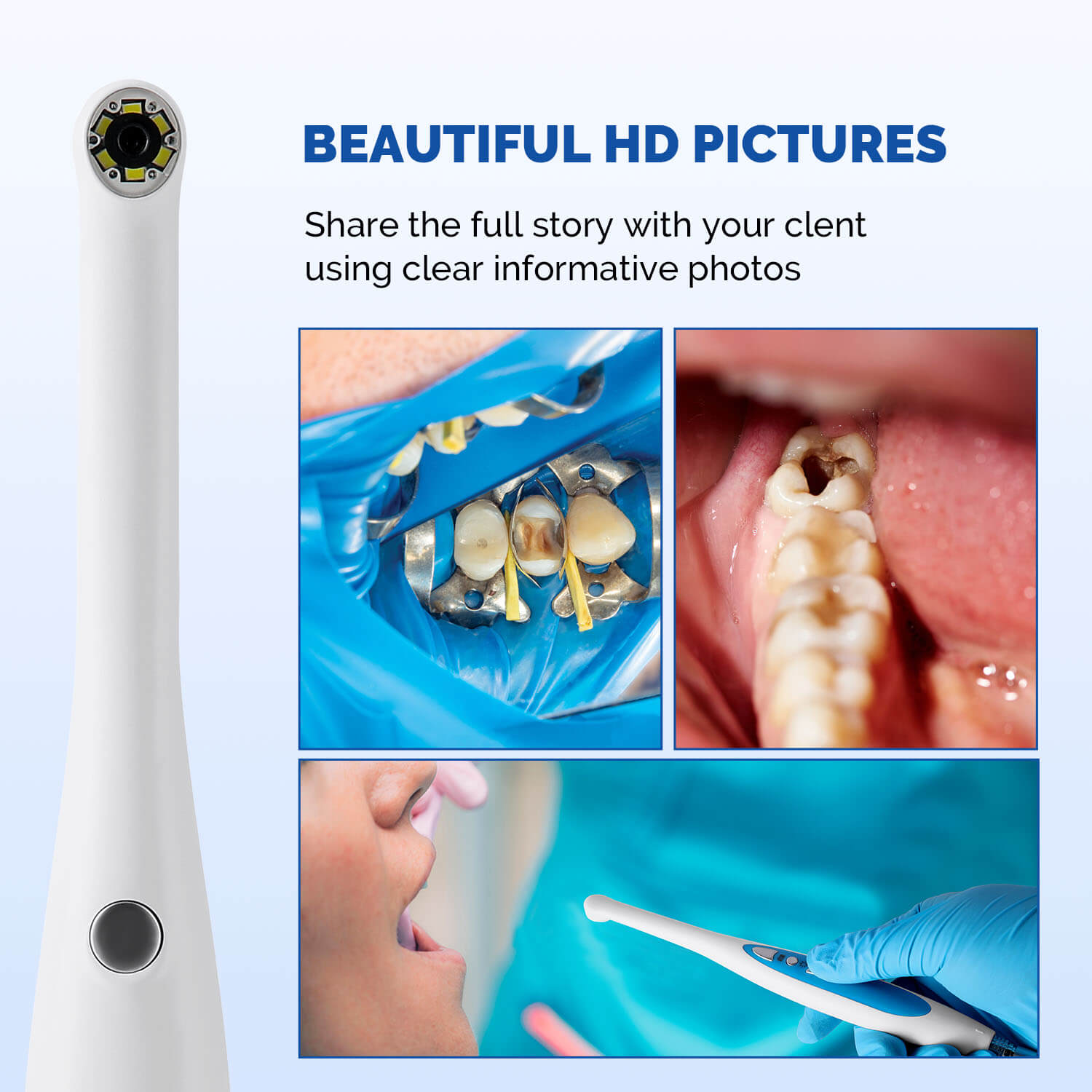 Dental USB Digital HD Intraoral Camera 6 LED White Lights AF Auto-focus - azdentall.com