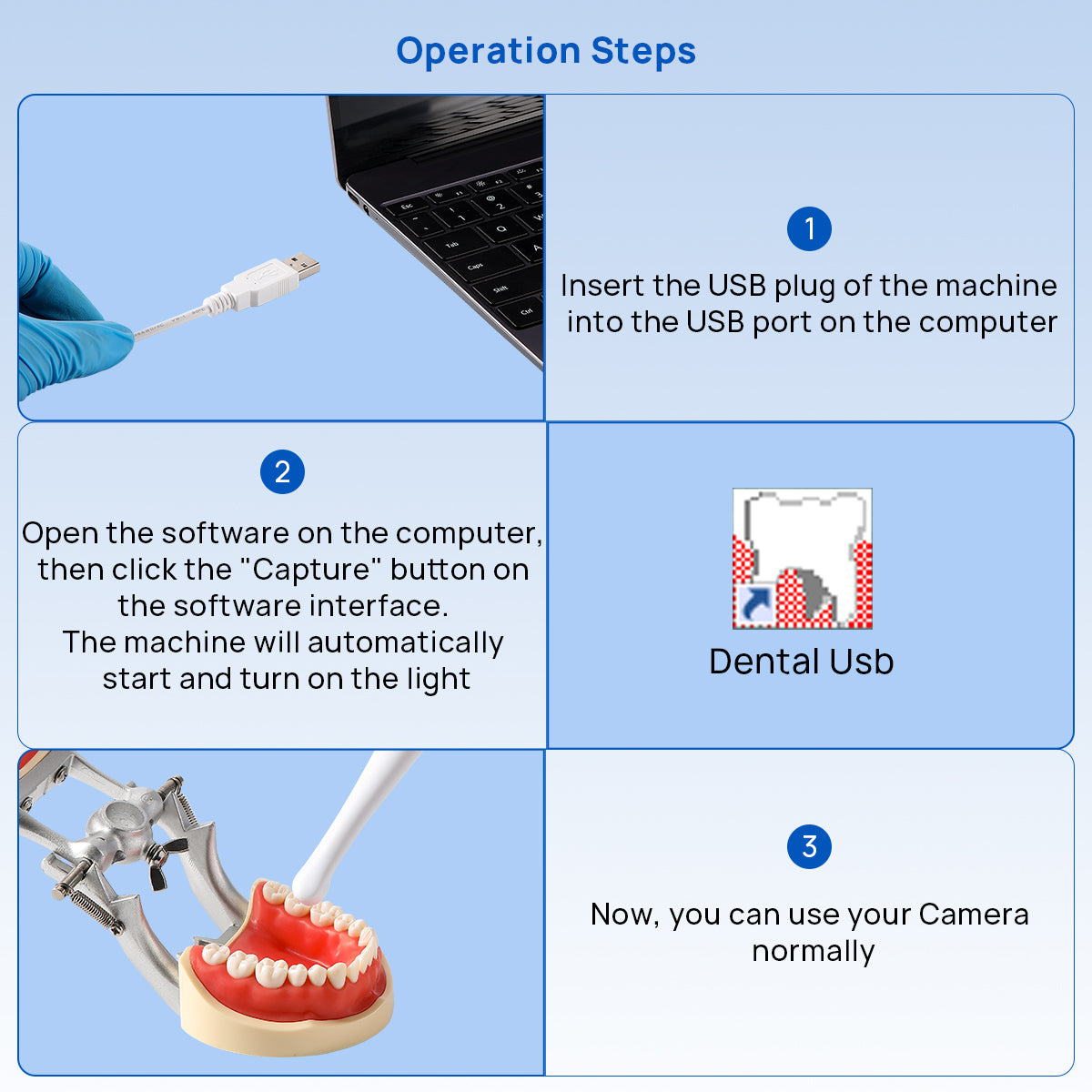 Dental USB Intraoral Camera Oral Endoscope HD Camera 13.0 Mega Pixels 6 LED Lights - azdentall.com