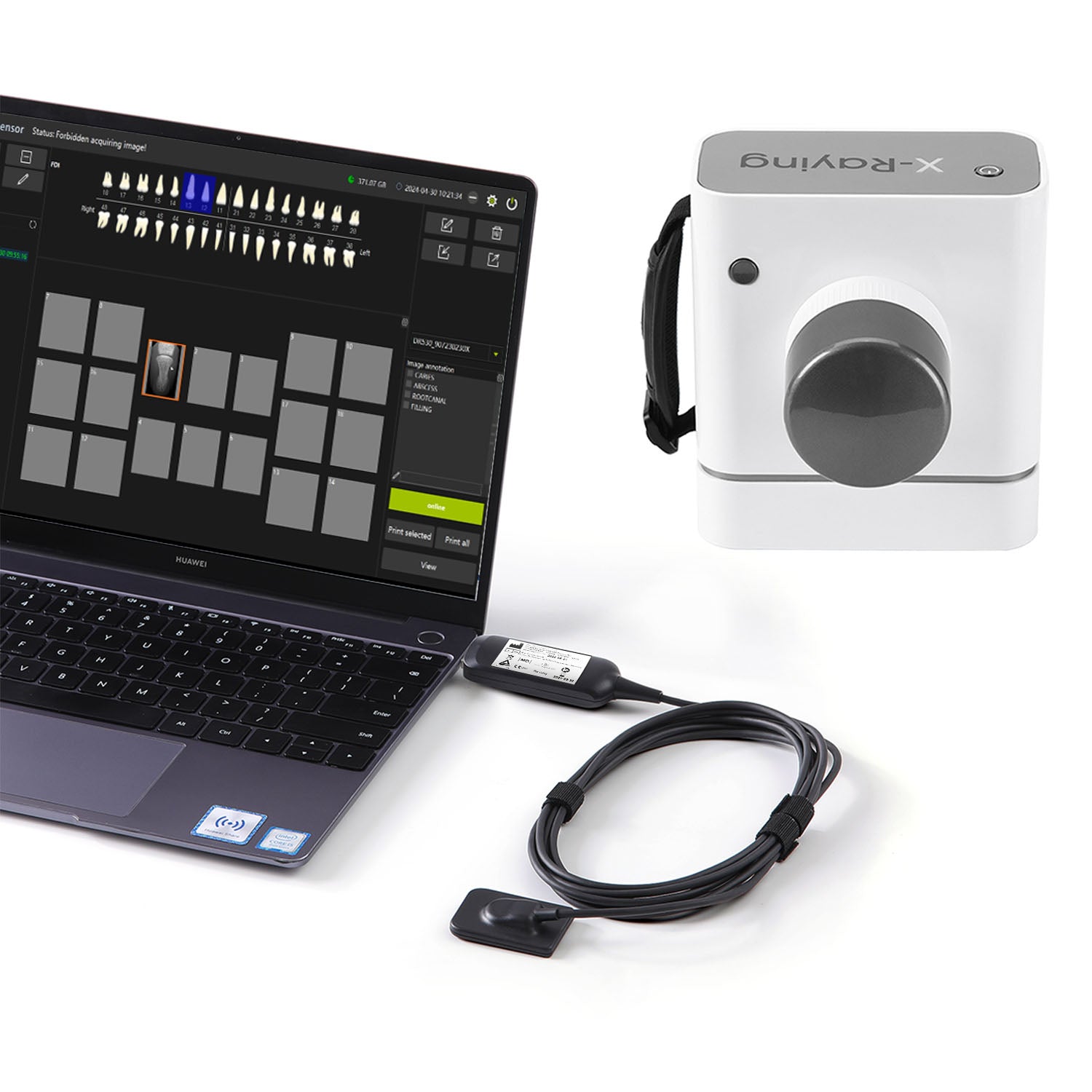 Dental Portable X Ray Machine with X-Ray Digital Intraoral Sensor S1/S1.5/S2 Kit - azdentall.com