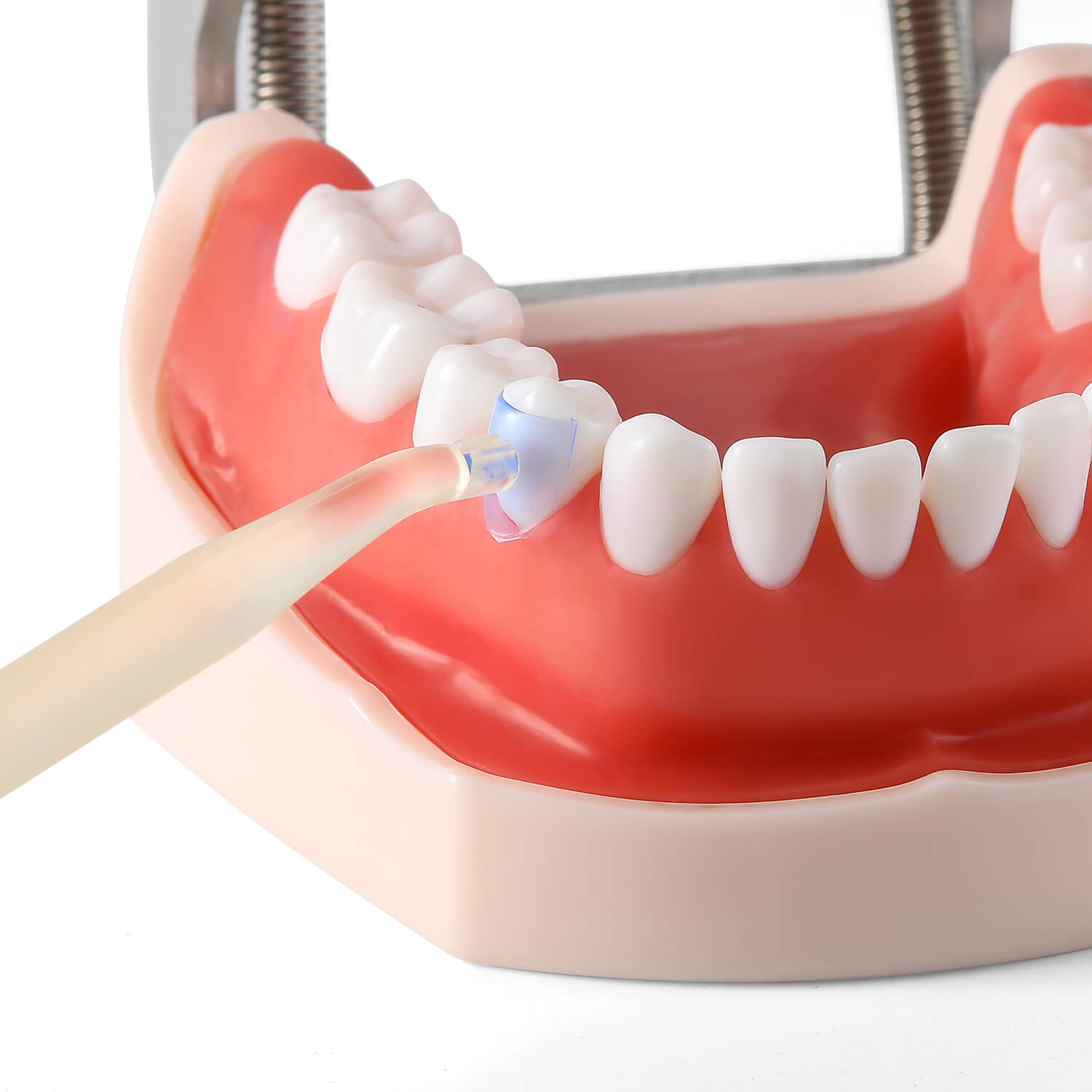 Dental Transparent Cervical Matrices Composite Gingival Retractor Matrix Band 100pcs/Box - azdentall.com