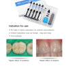 Light Cure Hybrid Dental Resin Composite 5 Syringe Kit A1 A2 A3 A3.5 B1 - azdentall.com