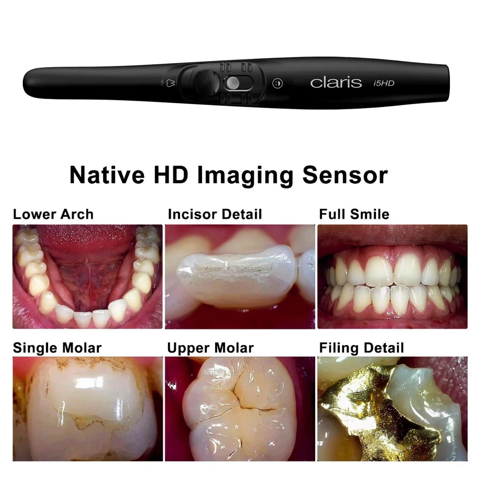 SOTA Imaging Claris i5HD Digital Intraoral Camera System CMOS Sensor - azdentall.com