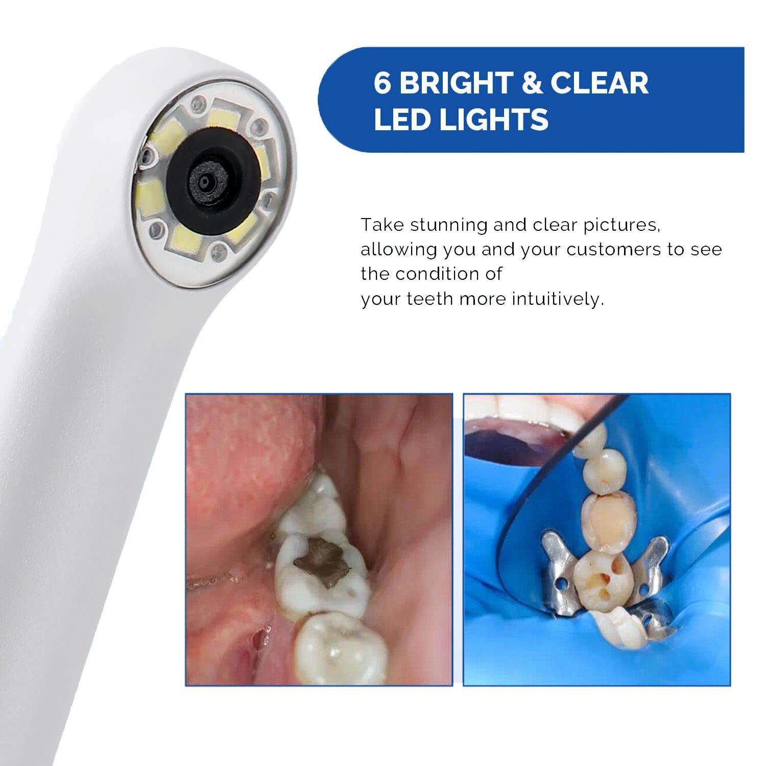 Dental USB Digital HD Intraoral Camera 6 LED White Lights AF Auto-focus