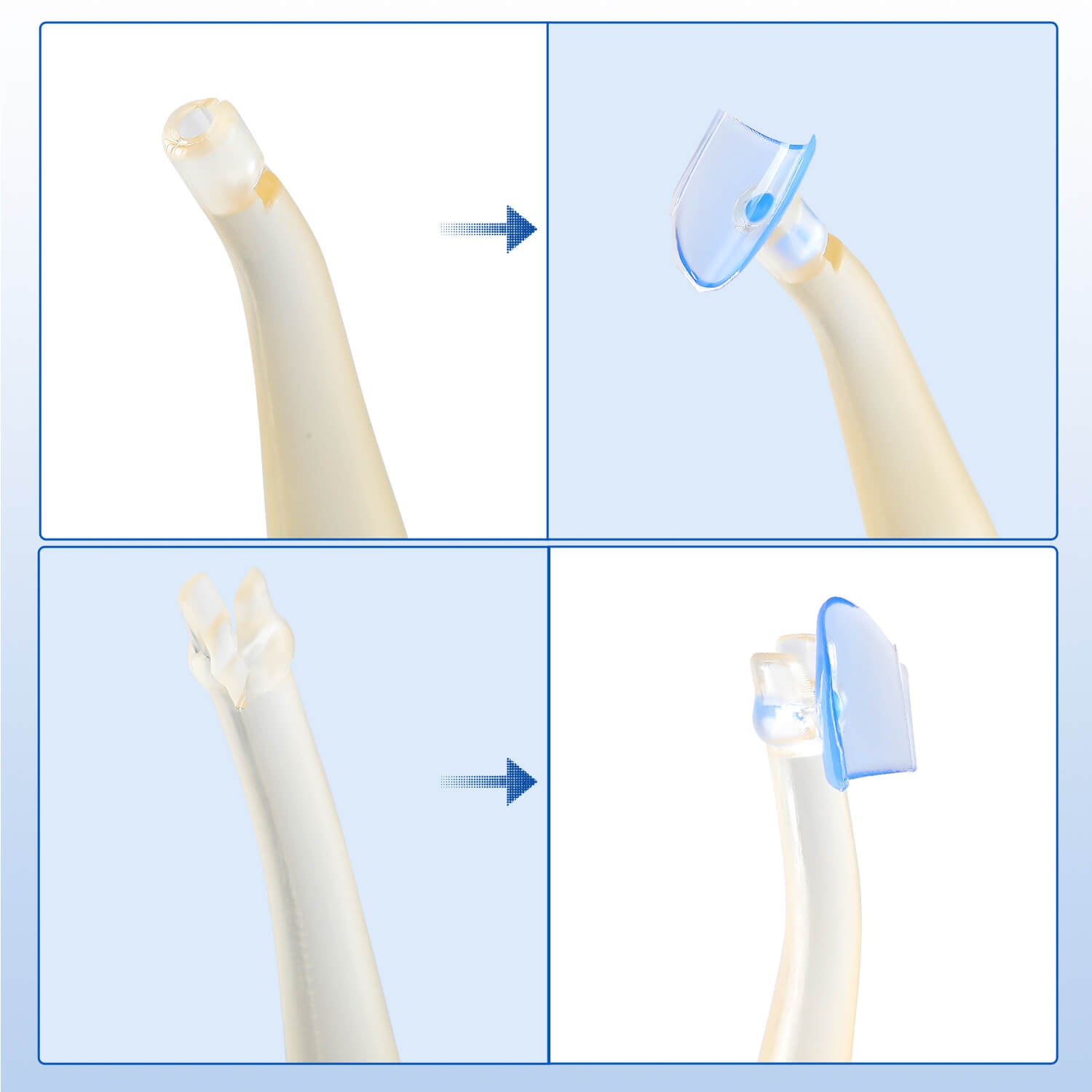 Dental Transparent Cervical Matrices Composite Gingival Retractor Matrix Band 100pcs/Box - azdentall.com