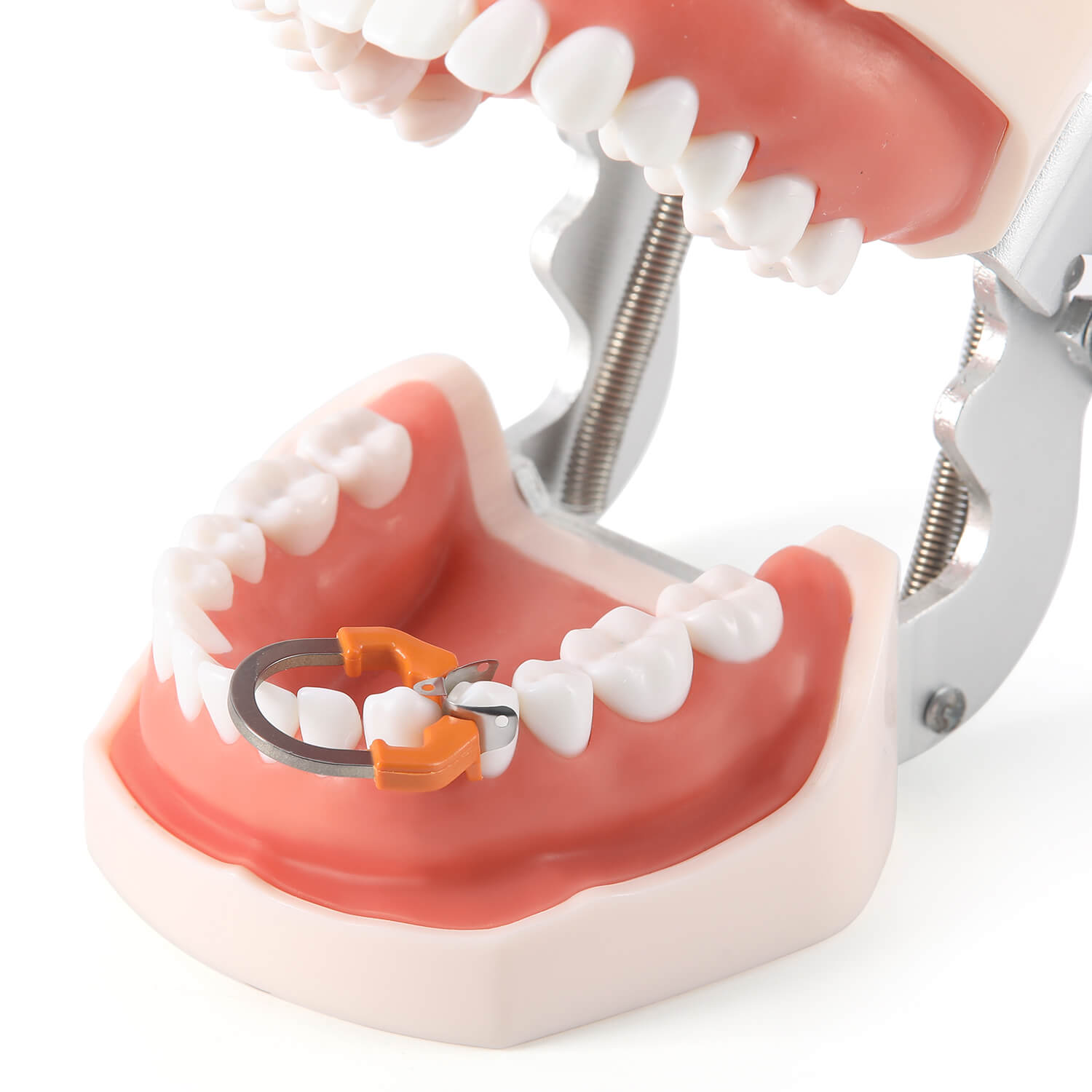 Dental Sectional Matrix System Sectional Contoured Matrix Bands Nickel Titanium Deep Clamping Ring Orange/Transparent 1 PC - azdentall.com