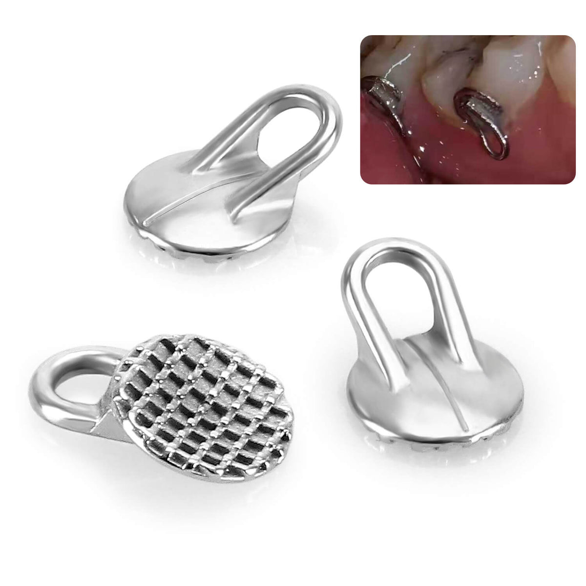 AZDENT Orthodontic Lingual Button Bondable Monoblock Traction Hook Round Base 50pcs/Box - azdentall.com