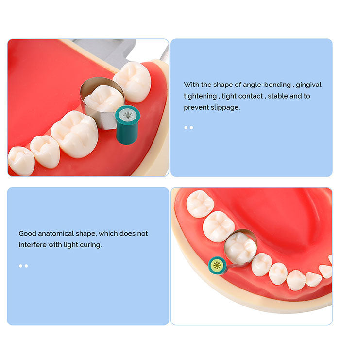 Dental Matrix Bands Stainless steel Double-Side Contoured Anatomically Shaped 0.038mm/ 0.03mm - azdentall.com