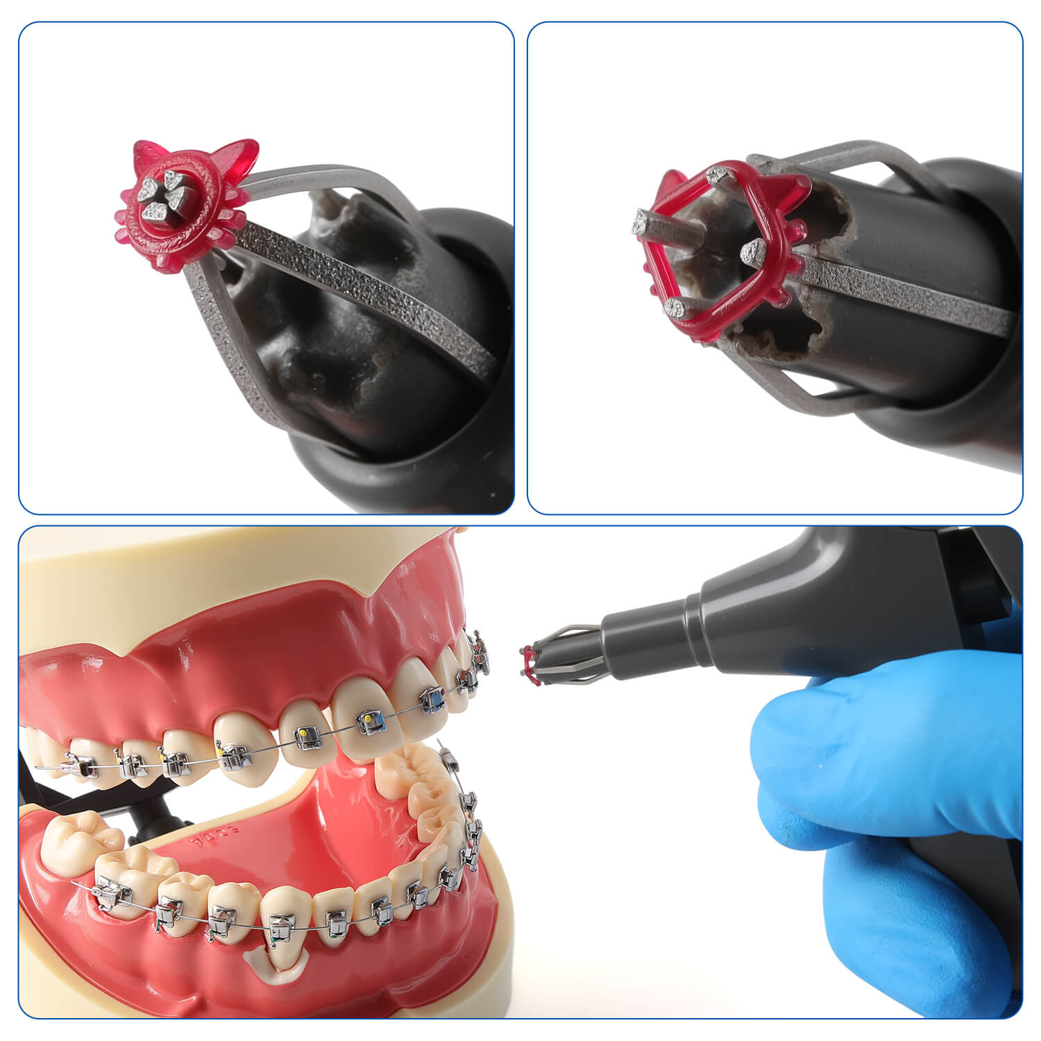 Dental Orthodontics Cartoon Elastic Ligature Ties Cat/Flower Type 1000pcs/Pack - azdentall.com