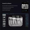 Woodpecker Dental Digital X-ray Imaging Plate Scanner i-Scan Wireless W/Screen - azdentall.com