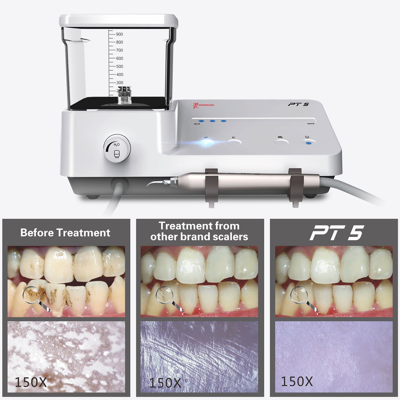 Woodpecker PT5 Endo Periodontal Treatment Device Auto Water Supply System - azdentall.com