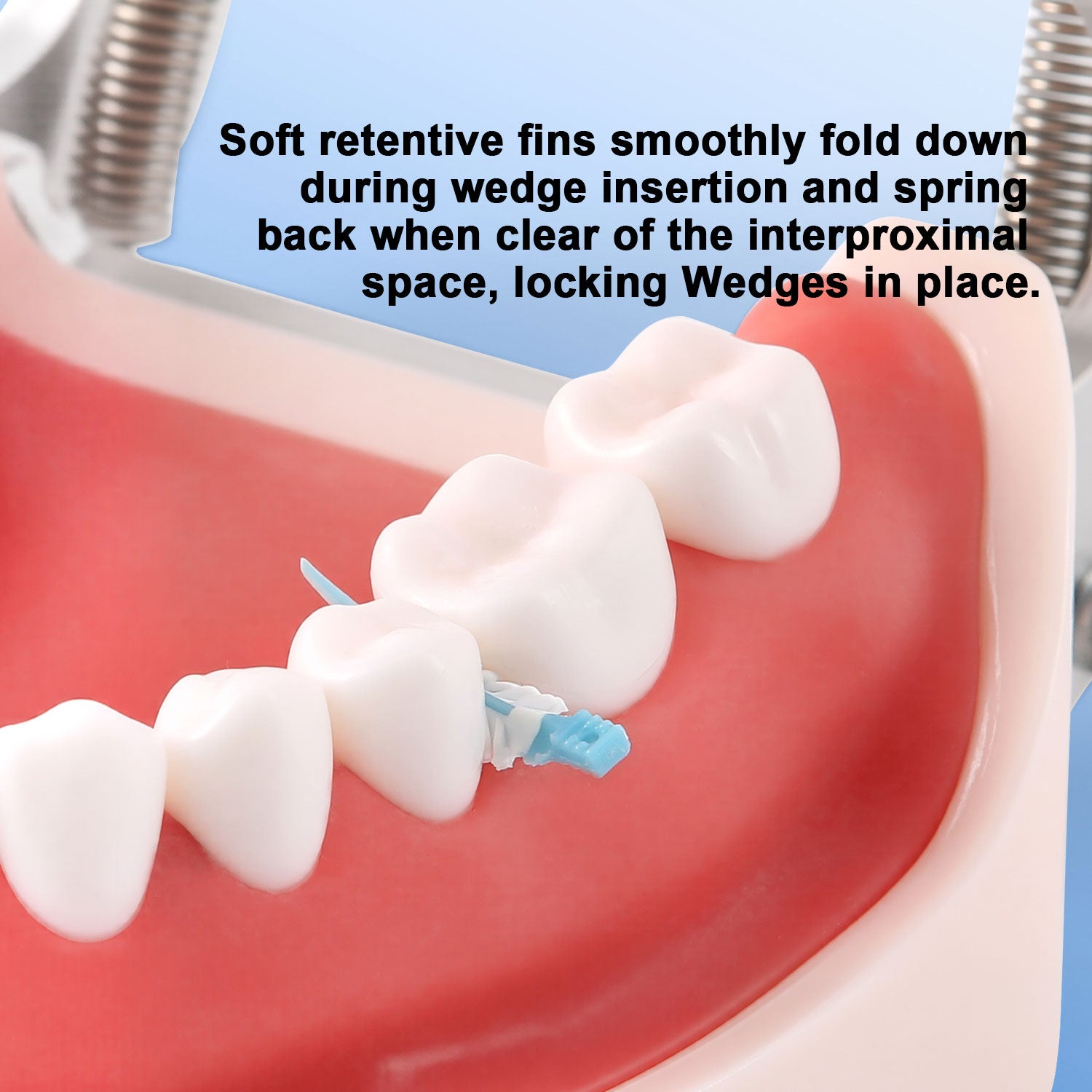 Dental Composite Wedges With Hole Strata Wedges Mixed Color - azdentall.com