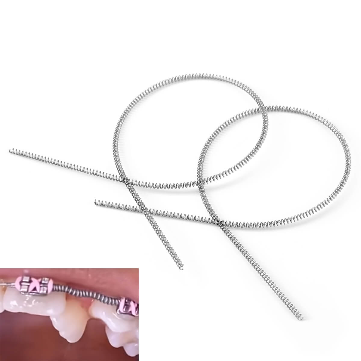 AZDENT Dental Open Coil Spring NITI Alloy 0.014*180mm 2pcs/Pk - azdentall.com