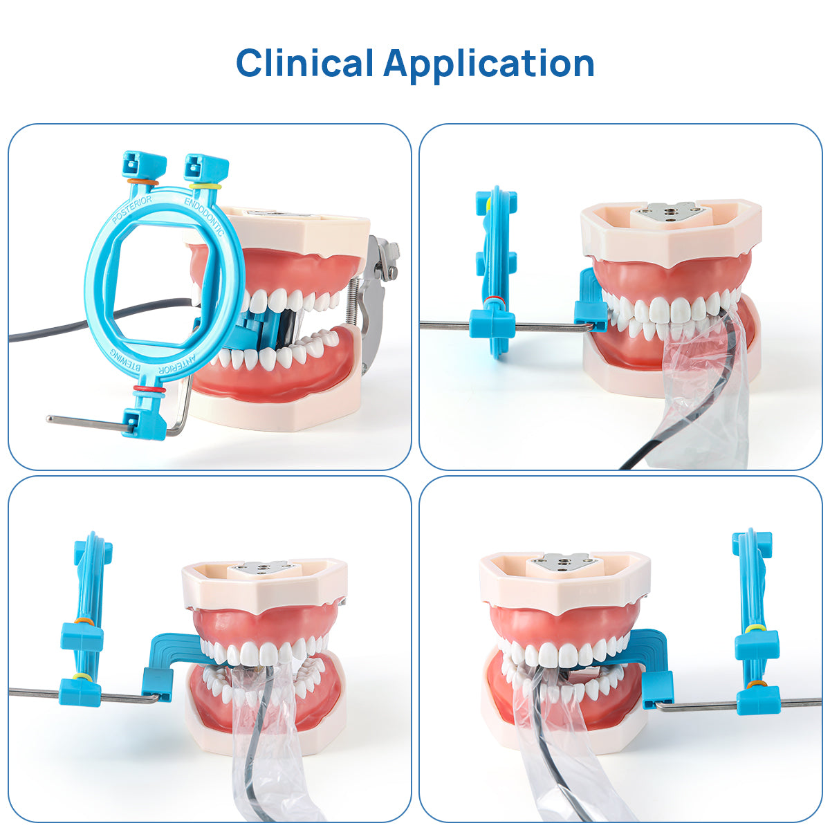 Dental X-Ray Positioner Digital Sensor Holder Positioning System 2.0 - azdentall.com